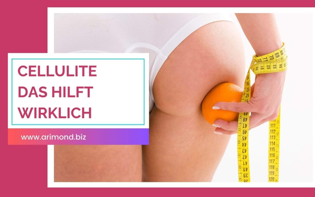 Behandlung von Cellulite – diese ungewöhnliche Kombi hat bei mir funktioniert!